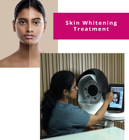 Skin Whitening Treatment